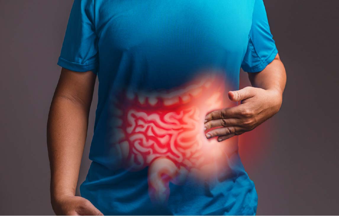 Can Colon Cancer Return After Surgery